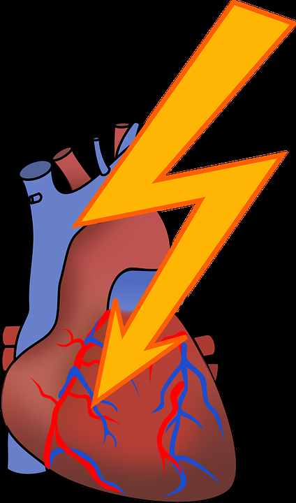 心脏骤停该如何处理？