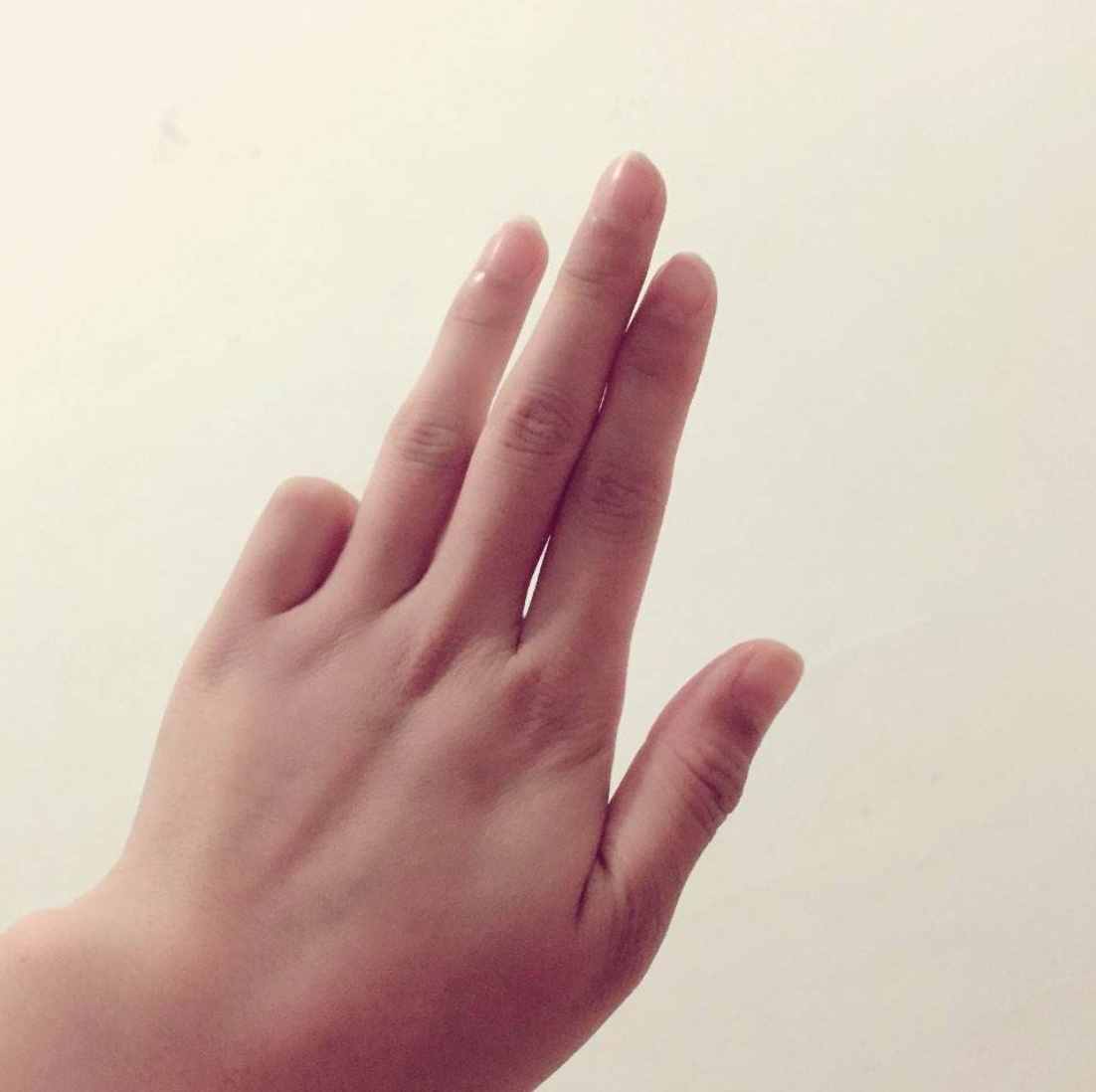 小手指短（小拇指短代表什么？）