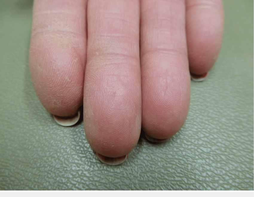 人类为啥会有指纹？祖先又不用指纹解锁，为何会进化出指纹？