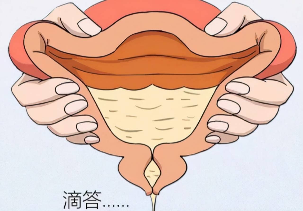 女性尿道口的结构是怎样的？
