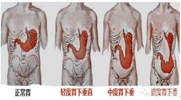 人的胃在身体的左边还是右边，你分的清楚吗？