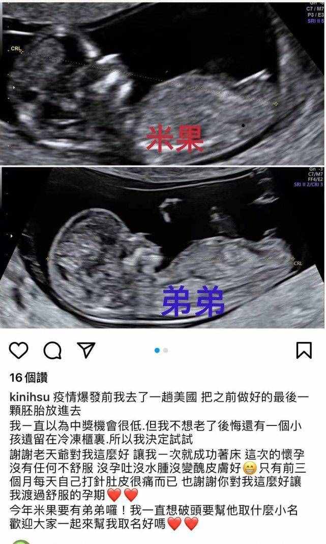 罗志祥43岁经纪人小霜宣布怀二胎，仍是试管婴儿，孩子父亲不详