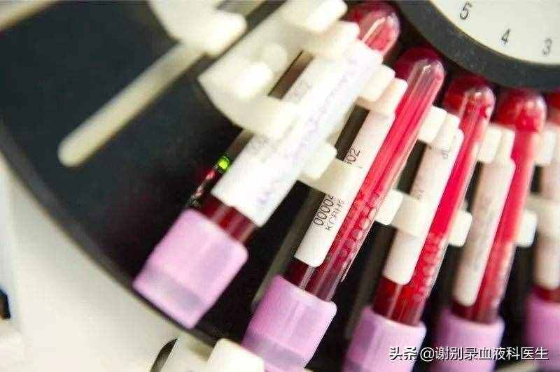 血细胞分析五大分类主要是查什么的？