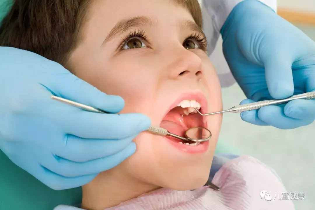 儿童龋齿怎么办，做好预防措施最重要