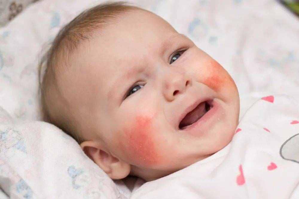 皮肤干燥、湿疹？0 香精不刺激的宝宝保湿乳来啦，敏感肌也能用