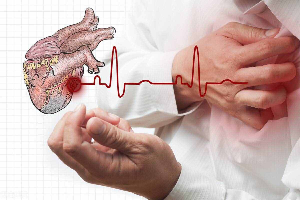 一起了解3个心绞痛的常见症状，中医是这样看待心绞痛的