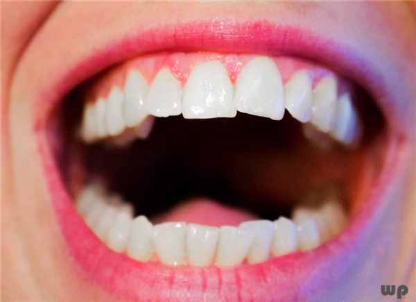 洗牙对牙齿有没有伤害（洗牙对牙齿有伤害吗？）
