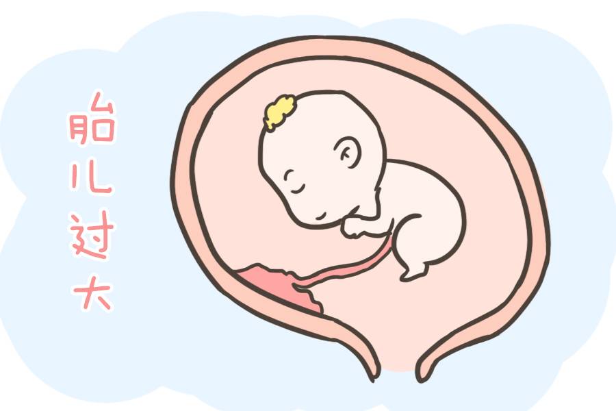准妈妈第一胎如果是剖腹产，那么第二胎该怎么生？看完这篇就懂了