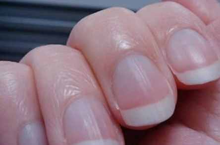 手指甲上有竖纹（指甲有竖纹，是身体的什么信号？）
