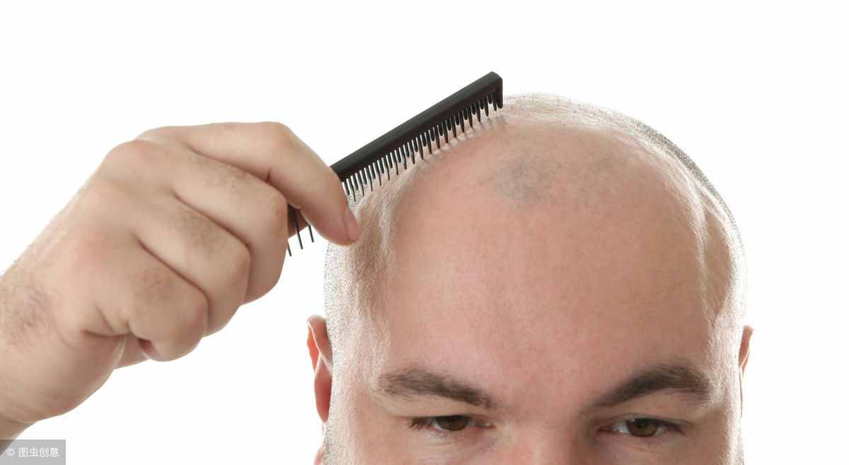 一个一天掉多少头发是正常的（人正常每天掉几根头发？）